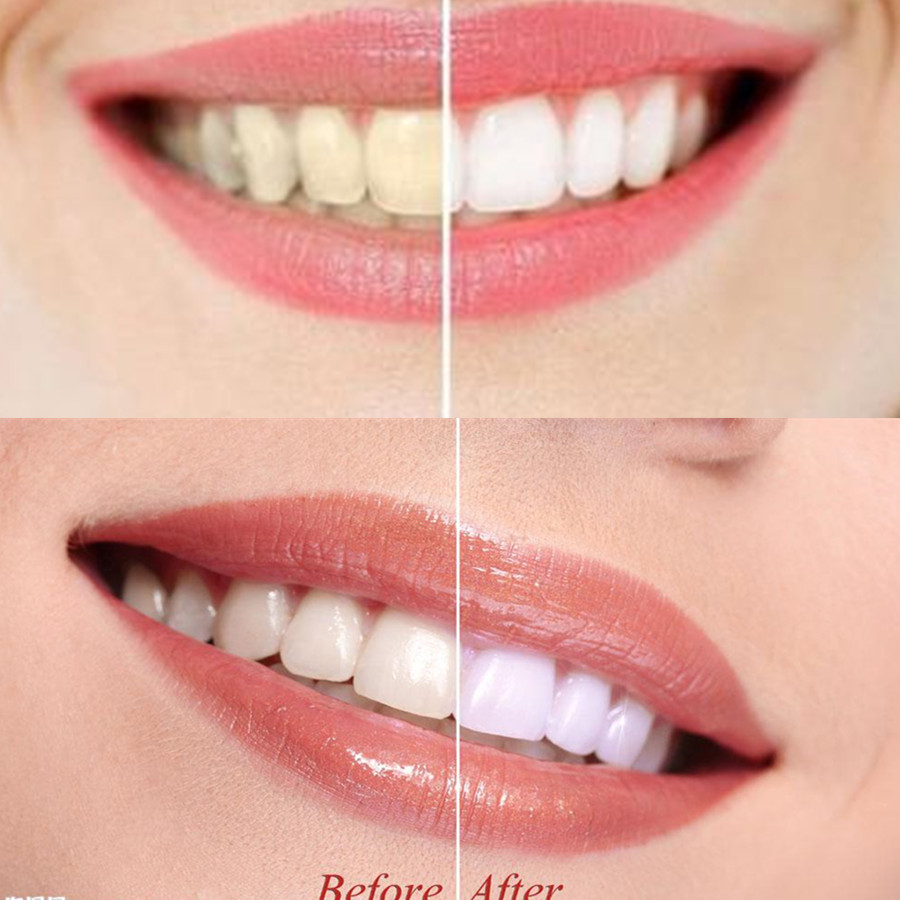 ถ่านไม้ไผ่ฟันฟันทันตกรรมสูตร L - Teeth Whitening Filter บทวิจารณ์และราคา