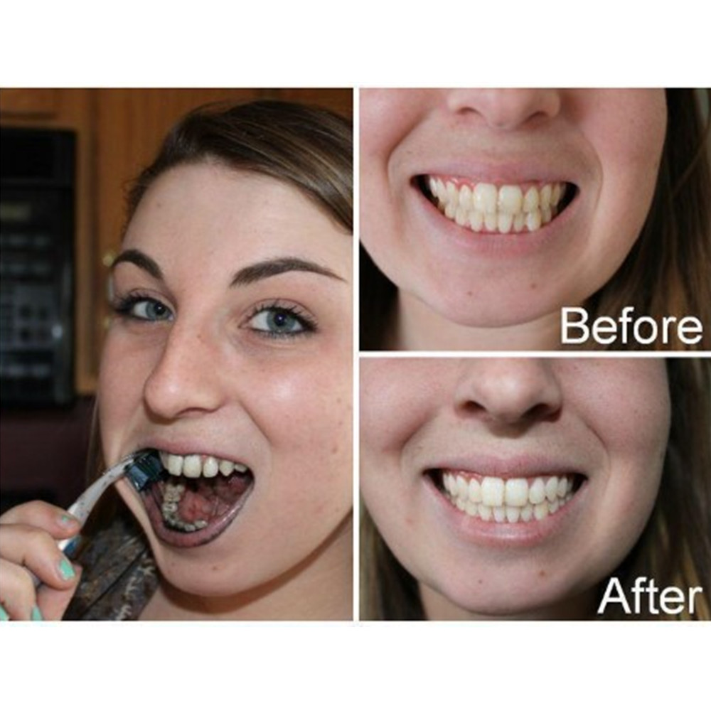 ถ่านไม้ไผ่ฟันฟันทันตกรรมสูตร L - Teeth Whitening Filter บทวิจารณ์และราคา