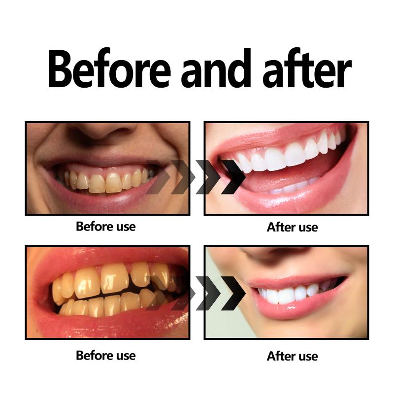 ผงถ่านไม้ไผ่ฟอกฟันขาวอย่างเป็น - Teeth Whitening Filter บทวิจารณ์และราคา