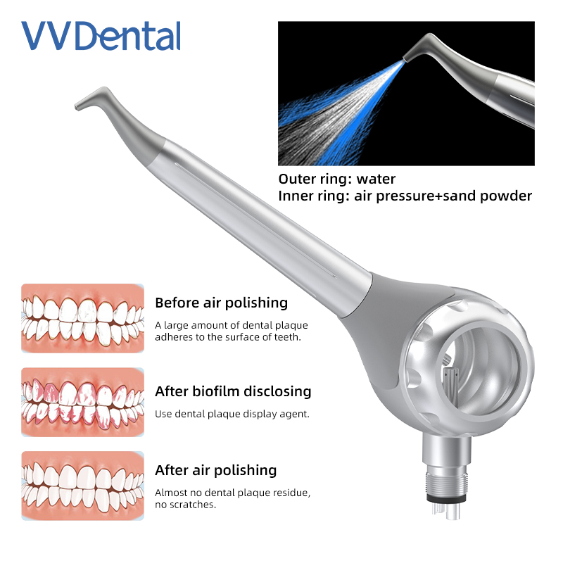 ปืนพ่นทรายฟอกสีฟัน VV Dental 2 - Teeth Whitening Usa บทวิจารณ์และราคา