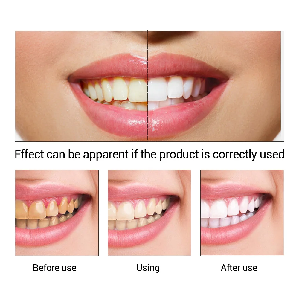 FTEENPLY ฟันไวท์เทนนิ่ง Oral ส - Teeth Whitening Natural บทวิจารณ์และราคา