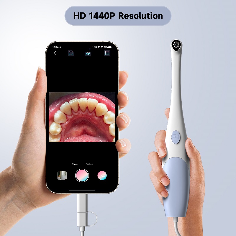 กล้องเอนโดสโคปสำหรับตรวจช่องปา - Teeth Whitening Video บทวิจารณ์และราคา