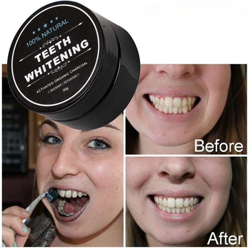 ผงฟอกสีฟันถ่านกัมมันต์ 1 กล่อง - Whitening Powder Activated บทวิจารณ์และราคา
