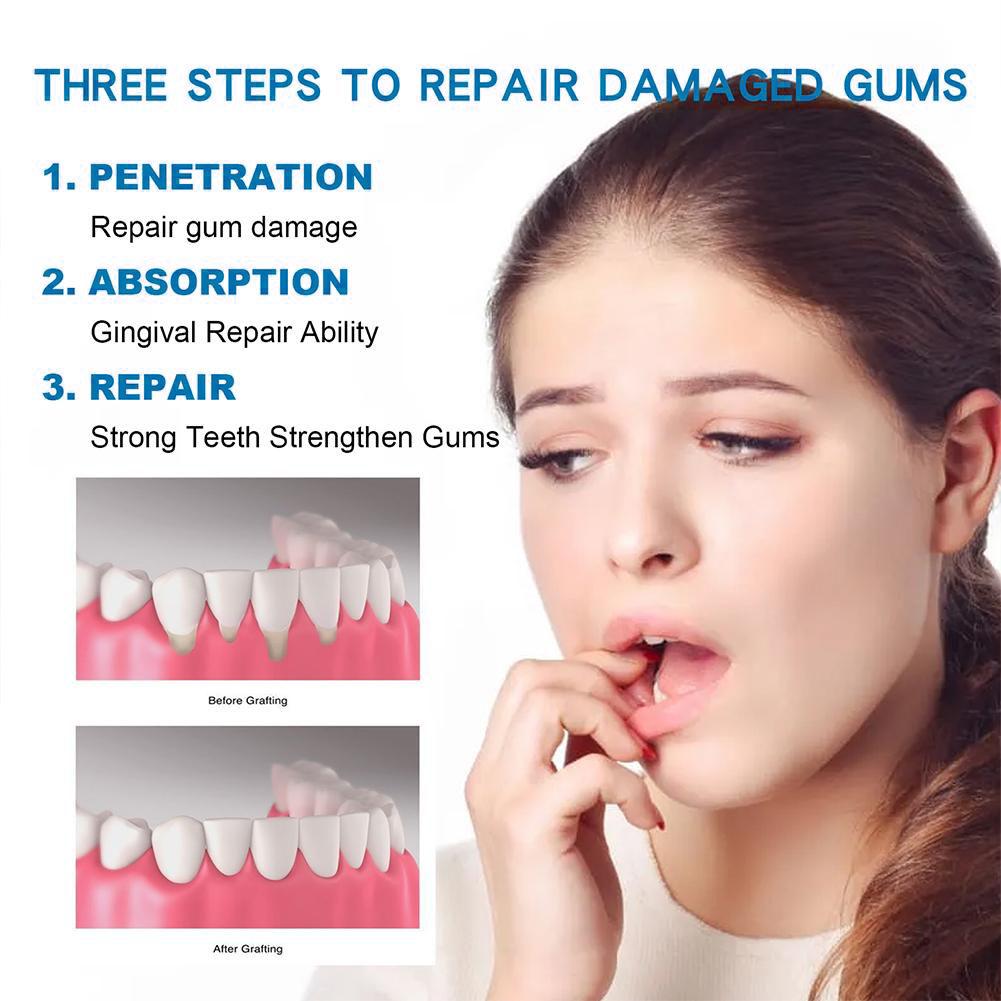 ยาสีฟันดูแลสุขภาพช่องปาก ยาสีฟ - Teeth Whitening Natural บทวิจารณ์และราคา