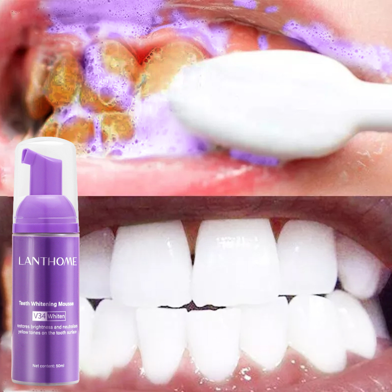 มูสฟอกฟันขาว V34 ยาสีฟันขจัดคร - Teeth Whitening Xylitol บทวิจารณ์และราคา