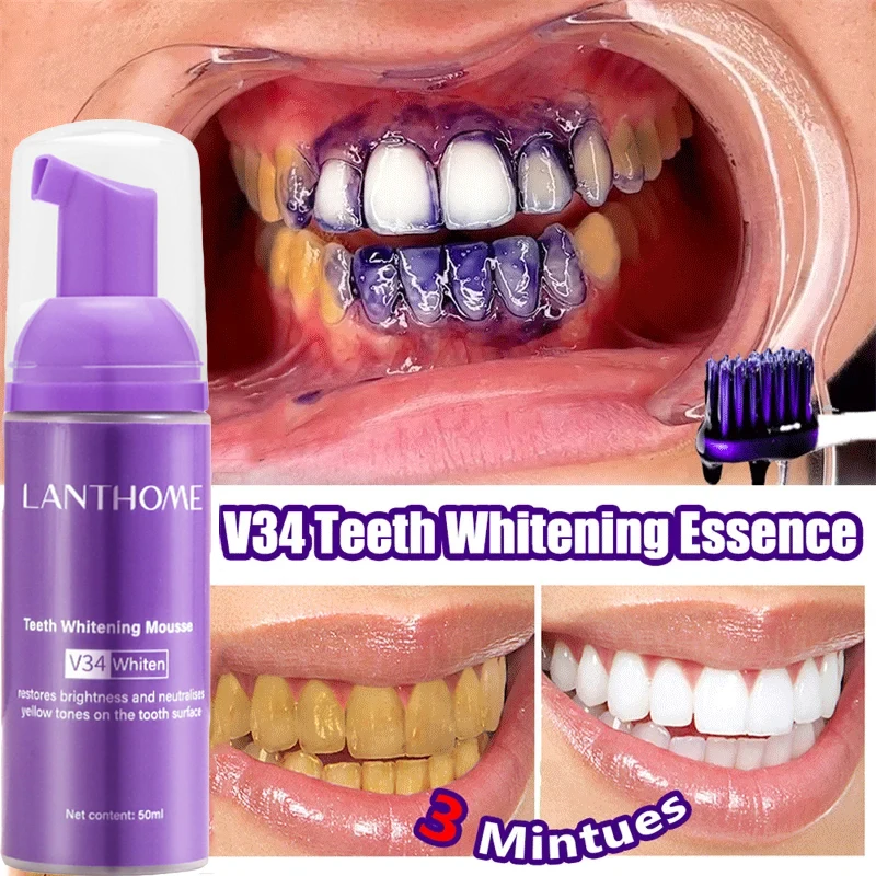 มูสฟอกฟันขาว V34 ยาสีฟันขจัดคร - Teeth Whitening Xylitol บทวิจารณ์และราคา