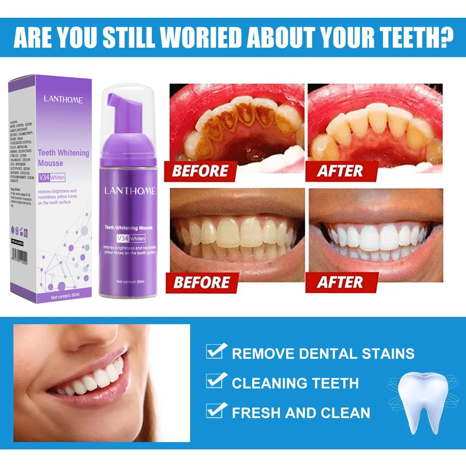 มูสฟอกฟันขาว V34 ยาสีฟันขจัดคร - Teeth Whitening Xylitol บทวิจารณ์และราคา