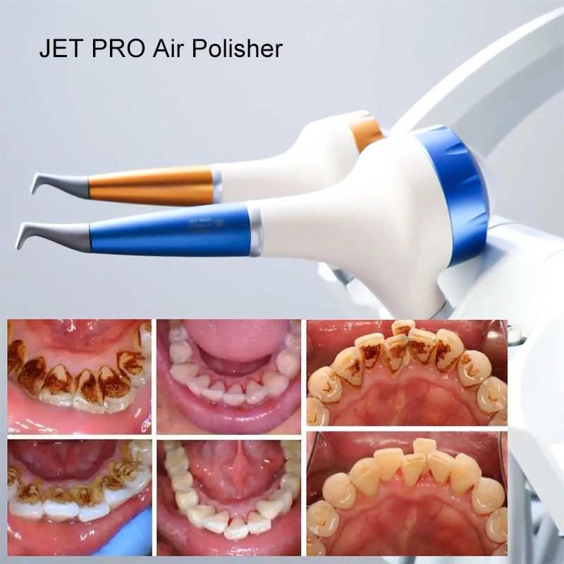 เครื่องขัดฟันด้วยลม VV Dental  - Teeth Whitening Usa บทวิจารณ์และราคา