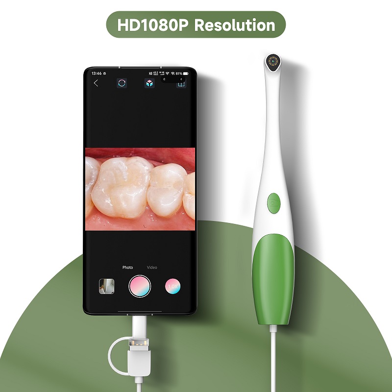 กล้องส่องตรวจช่องปากแบบพกพา TY - Teeth Whitening Video บทวิจารณ์และราคา