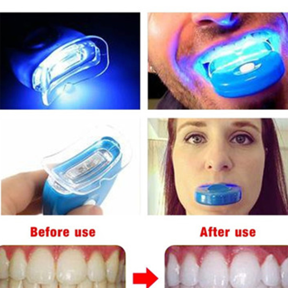 Led ใหม่สีฟ้าฟัน Whitening Acc - Teeth Whitening Video บทวิจารณ์และราคา