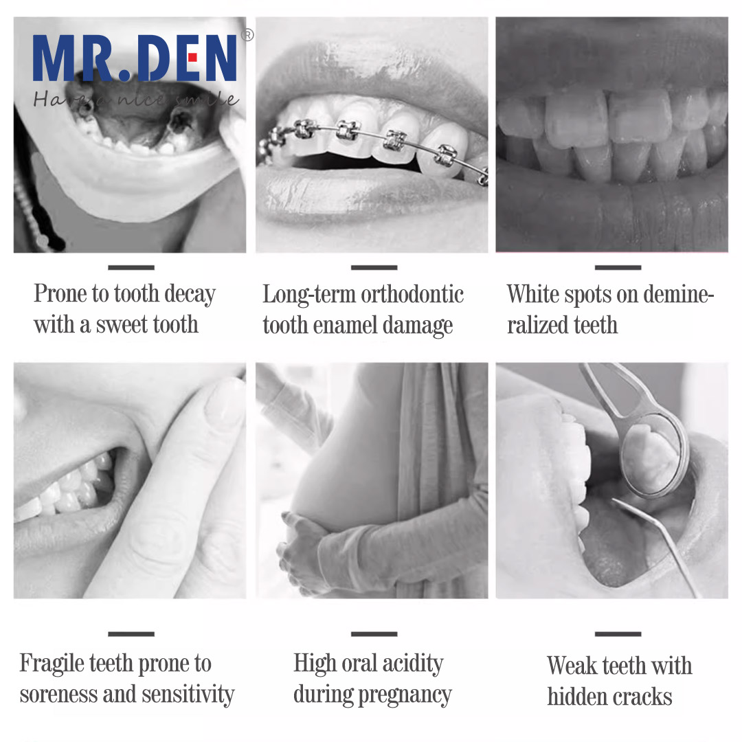 ญี่ปุ่น GC Fluoride Enhanced D - Teeth Whitening In Japan บทวิจารณ์และราคา